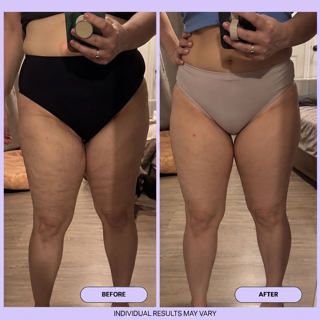 Anti-Cellulite Smoothing Massage Oil