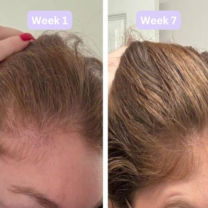 Korean Hair Growth Serum