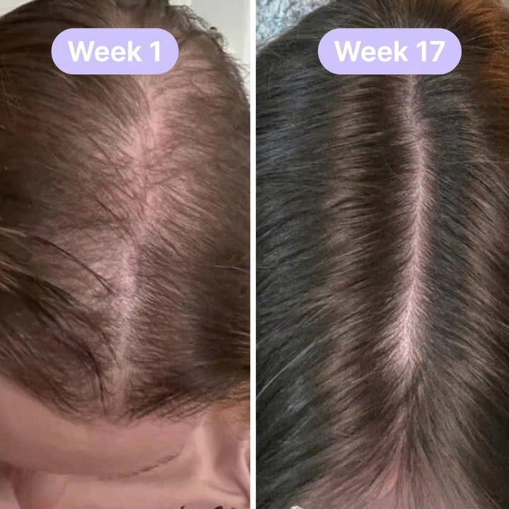 Korean Hair Growth Serum
